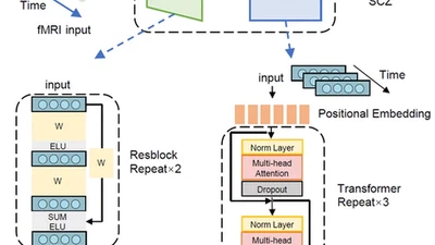 The Neurodynamic Computational Model Reveals Abnormal Multistable Spatiotemporal Patterns and Mechanisms in Schizophrenia featured image