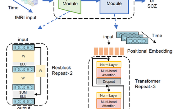 The Neurodynamic Computational Model Reveals Abnormal Multistable Spatiotemporal Patterns and Mechanisms in Schizophrenia featured image